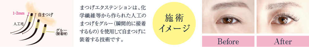 まつげエクステンションは、化学繊維等から作られた人口のまつげをグルー（瞬間的に接着するもの）を使用して自まつげに装着する技術です。